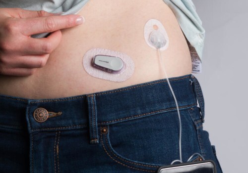 Hypoglycemia: Understanding the Causes, Symptoms, and Immediate Treatment