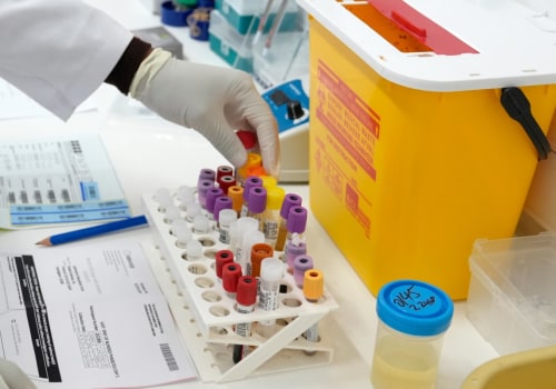 What Does HIV Stand For? Unpacking the Term, Its Medical Significance, and How It Shapes Global Health Initiatives